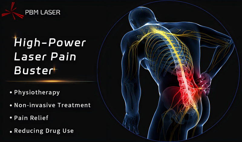 PBM Medical Laser 丨 ปลดล็อกรหัสการฟื้นฟู เลเซอร์กำลังสูงได้รับคำแนะนำเกรด A ในแนวทางการวินิจฉัยและการรักษาอาการปวดหลังส่วนล่างเรื้อรังของจีน (ฉบับปี 2024)